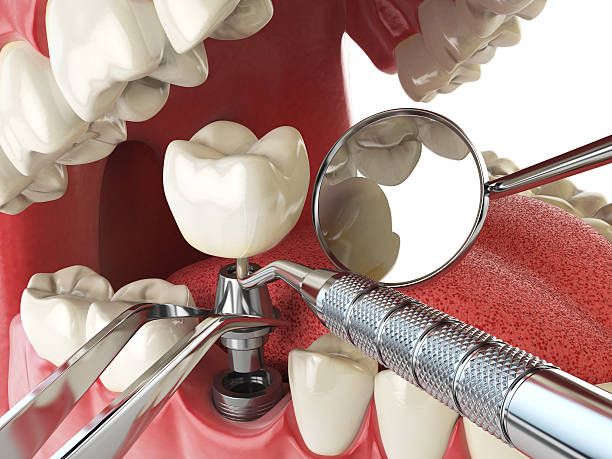 Best Dentist for Tooth Abscess  in Long Branch, VA